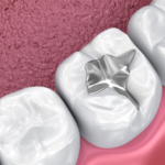 Mercury Free Dentistry Could Make You Healthier