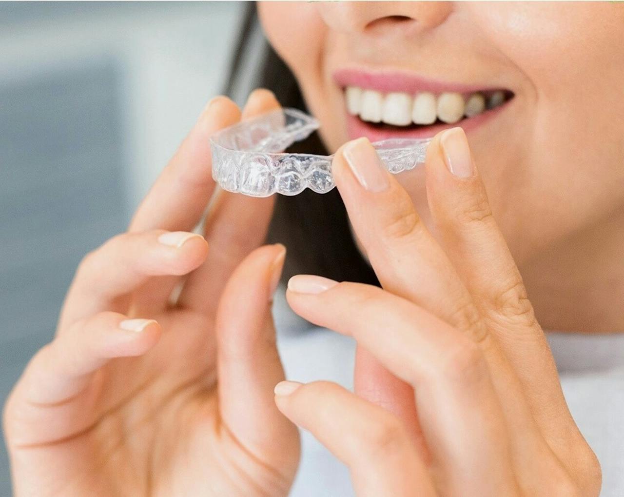 Invisalign_Glenview_cosmetic_dentist